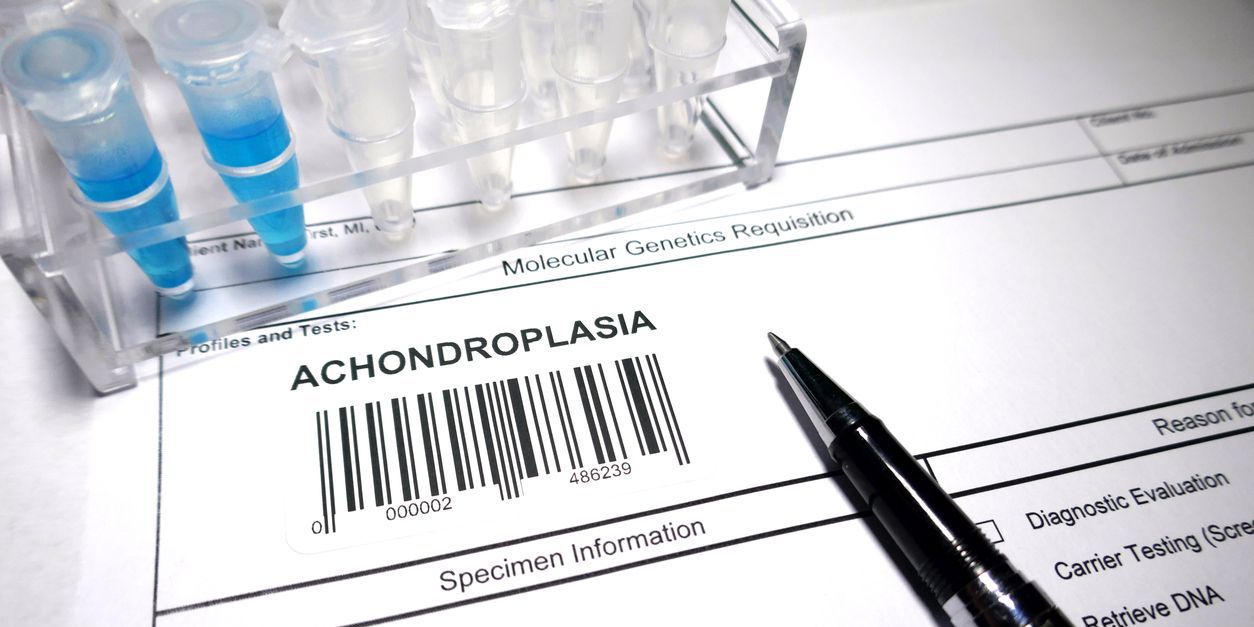 Terapia semanal acelera el crecimiento en niños con acondroplasia Imágen de portada