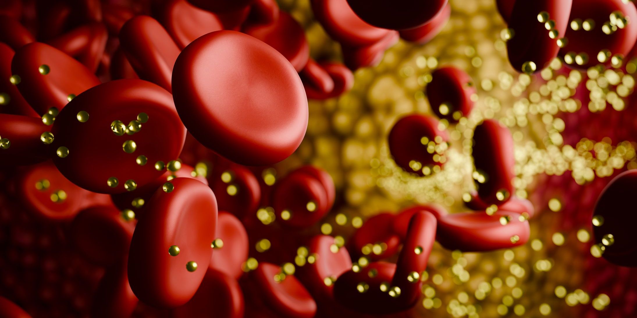 Guía Actualizada de Dislipidemia Potencia la Prevención de ASCVD Imágen de portada
